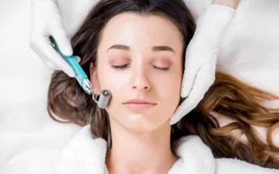 Capitalize on the MicroNeedling Trend: Get Macro Leads